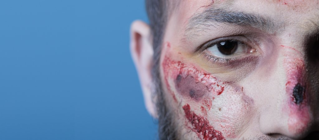 Einsatz gegen häusliche Gewalt